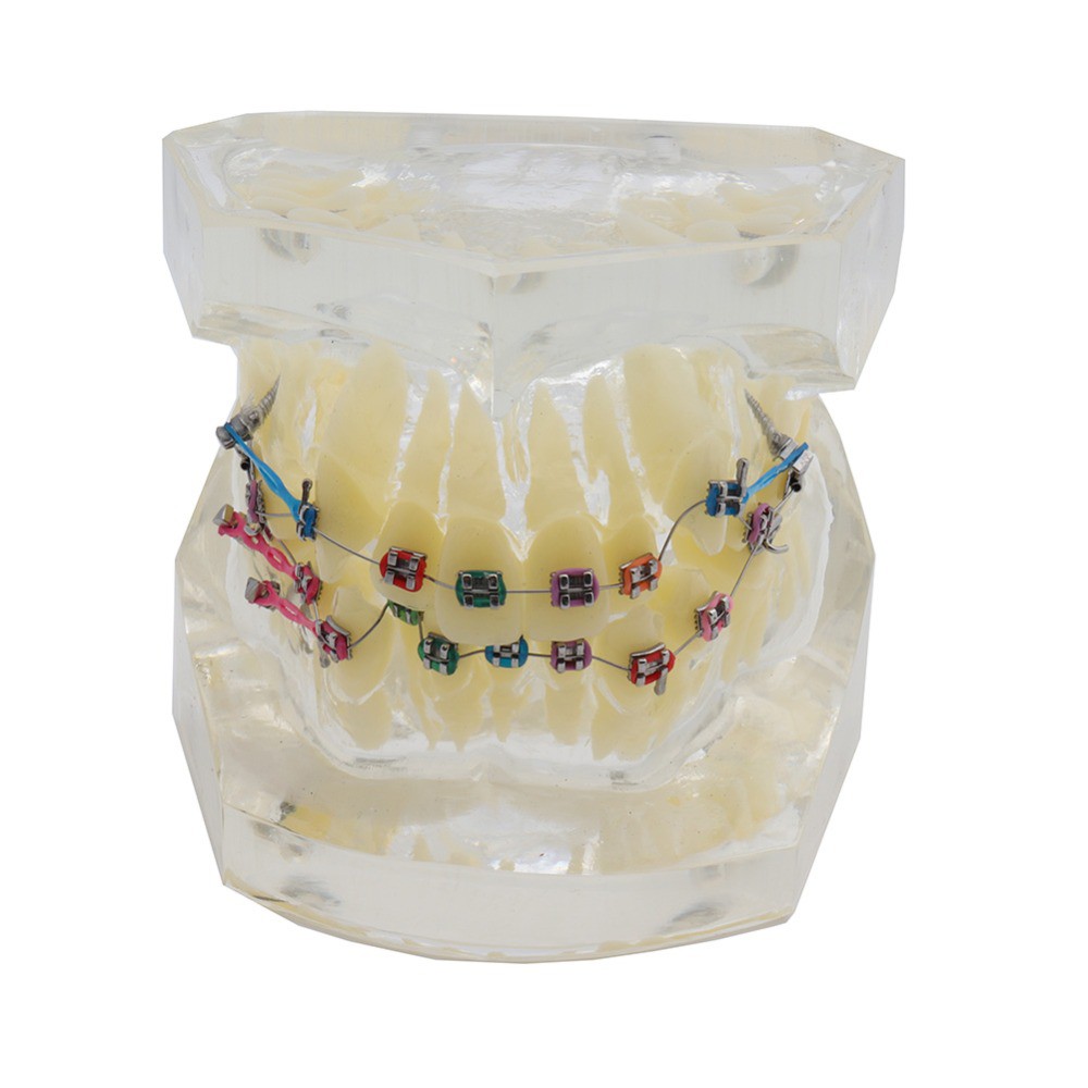 ทันตกรรมการจัดฟัน Dental Standard Orthodontic Teeth Model with Brackets ...