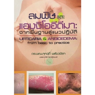 ลมพิษและแองจิโออีดีมา :จากพื้นฐานสู่แนวปฏิบัติ (URTICARIA &amp; ANGIOEDEMA: FROM BASIC TO PRACTICE) (9786165728966)