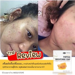 [ส่งไวมาก เปิดขนส่งเอง] สบู่พิมพ์เพกา ลดสิว หน้าสว่างใสอย่างเป็นธรรมชาติ