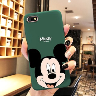 ▩OppoA59 following oppoA77 female money a59 cases opop cartoon silicone A59s male soft shell a77 thin