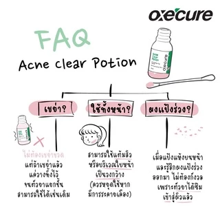 Oxe'cure แต้มสิว แป้งน้ำชมพูลดสิว Acne Clear Potion 15 ml จากประเทศญี่ปุ่น เจลแต้มสิว ลดสิว รอยดำ oxecure อ๊อกซีเคียว