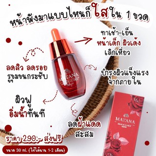 ของแท้💯 ส่งฟรี Matana Serum 30 ml.เซรั่มมัทนา เซรั่มกุหลาบ  เซรั่มลดสิว หน้าขาวใส ควบคุมความมัน ลดริ้วรอย กระชับรูขุมขน