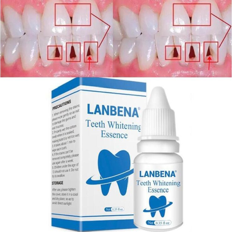 LANBENA ลานบีน่า ผงฟอกสีฟัน เจลทําความสะอาดสุขอนามัยในช่องปาก ลบ