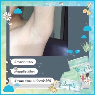 ของแท้💯พร้อมส่ง 💙ครีมรักแร้ขาว ไวท์อัพอาร์มพิท💙 (รับตรงจากบริษัท) โปรดระวังของ**ปลอ-ม**