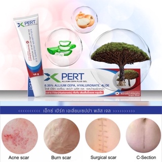 (ล็อตใหม่สุด 18/1/26) XPERT Allium Cepa Plus Gel 10g ลดรอยแผลเป็น ลดเลือนริ้วรอย [&gt;หลอดขาว&lt;]