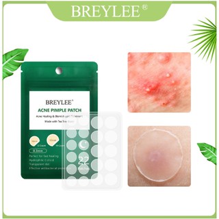 ฺBreylee แผ่นมาส์กกำจัดสิวเสี้ยน