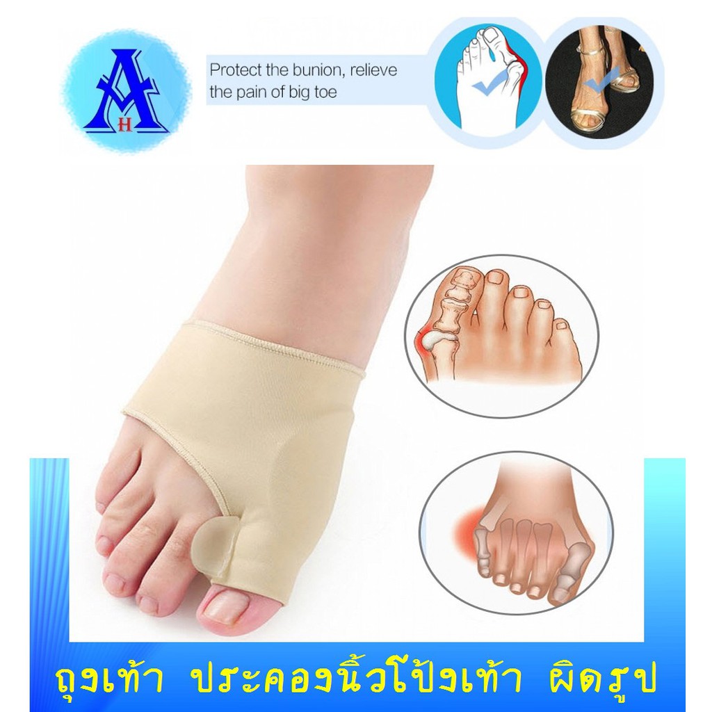 ถุงเท้าประคองนิ้วโป้งเท้าผิดรูป ผ้ารัดอุปกรณ์แก้ไขเท้าผิดรูป ช่วยกระชับนิ้วเท้าให้แน่น ไม่ให้พลิก ขณ