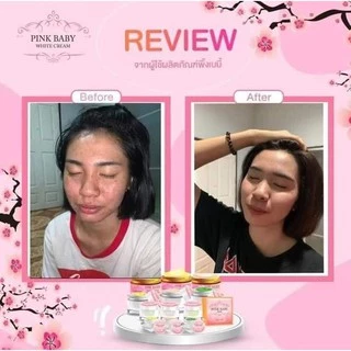 [ลดทันที 50฿ โค้ดDETSEP199] Pink Baby Cream ครีมพิ้งค์เบบี้ แบบชุด แบบแยก