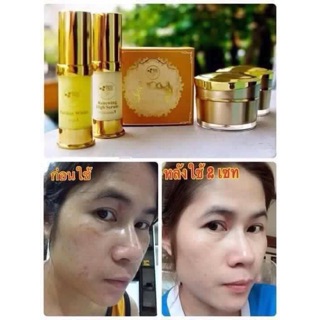 Gold set หน้าใสไร้สิว