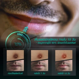 MASKTITZ ครีมทาปากชมพู-หัวนมชมพู ถาวร