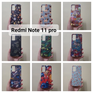 เคสแข็ง Redmi Note 11 pro เคสไม่คลุมรอบนะคะ เปิดบน เปิดล่าง (ตอนกดสั่งซื้อ จะมีให้เลือกลายก่อนชำระเงินค่ะ)