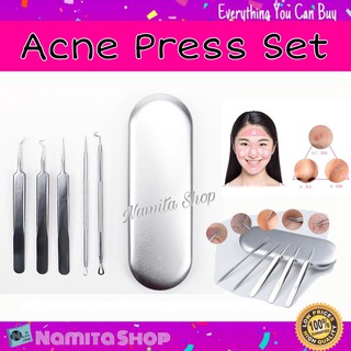 Namita Acne press set ที่กดสิว ชุดกดสิว ชุดอุปกรณ์กดสิว มืออาชีพ เซต 5 ชิ้น