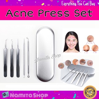 Namita Acne press set ที่กดสิว ชุดกดสิว ชุดอุปกรณ์กดสิว มืออาชีพ เซต 5 ชิ้น