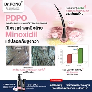 เซรั่มลดผมร่วง Dr.PONG TSUTSUJI HAIR REJUVENATING SERUM - anti-hairloss serum เซรั่มบำรุงผม ลดผมร่วง