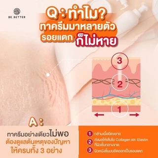 เซ็ทคู่ลดรอยแตกลาย Be Better ครีมน้ำตบสยบรอยแตก + เจลสมานผิว ครีมลดรอยแตกลาย จากทุกสาเหตุ