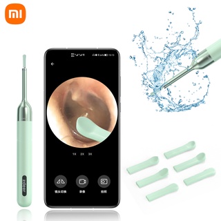 Xiaomi ZDEER เครื่องมือกําจัดขี้หู พร้อมไฟ LED 6 ดวง 1080P HD IP67 กันน้ํา สําหรับ iOS 5 ชิ้น