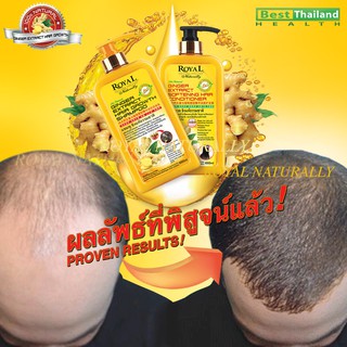 Royal Naturally Ginger Hair Growth Shampoo &amp; Conditioner Set  ขิง แชมพูและครีมนวดผม 1000ml x 2