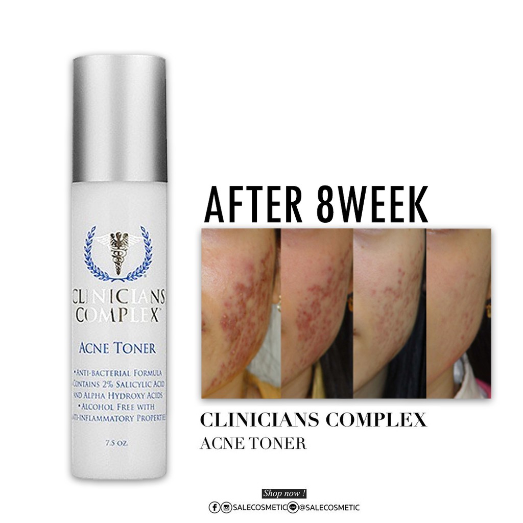 clinicians complex acne toner