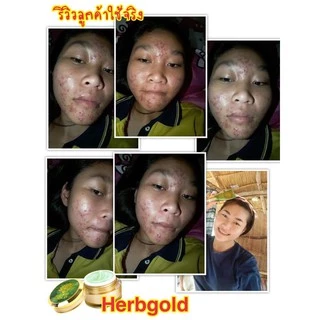 HERB Gold ครีมเฮิร์บ โกลด์ ชุด ครีม 30กรัม+ สบู่ 50 กรัม