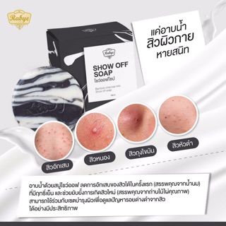 ส่งฟรี‼️ Show off soap ลดสิวผิวกาย Rabye