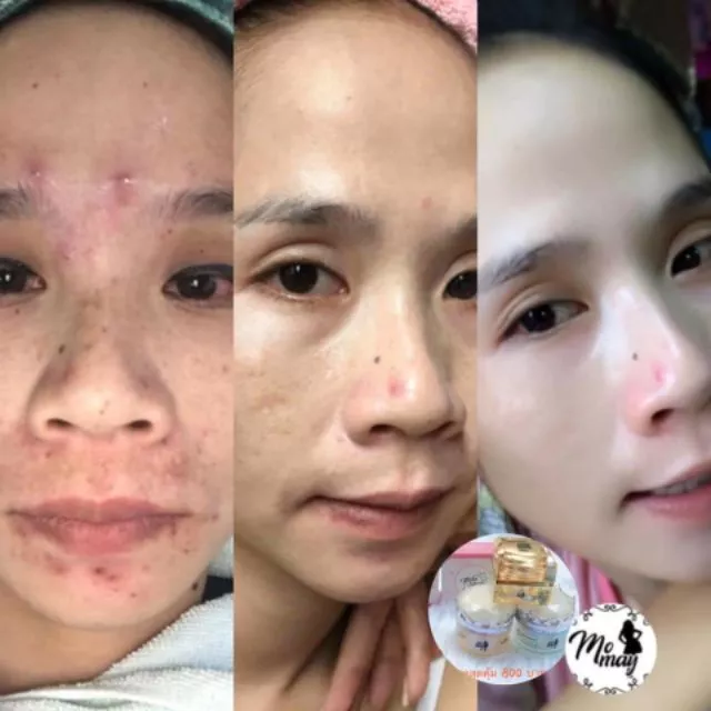 ครีมเอลลี่โมเม ไนท์ครีมบำรุงผิว ขนาด 10g thumbnail 9