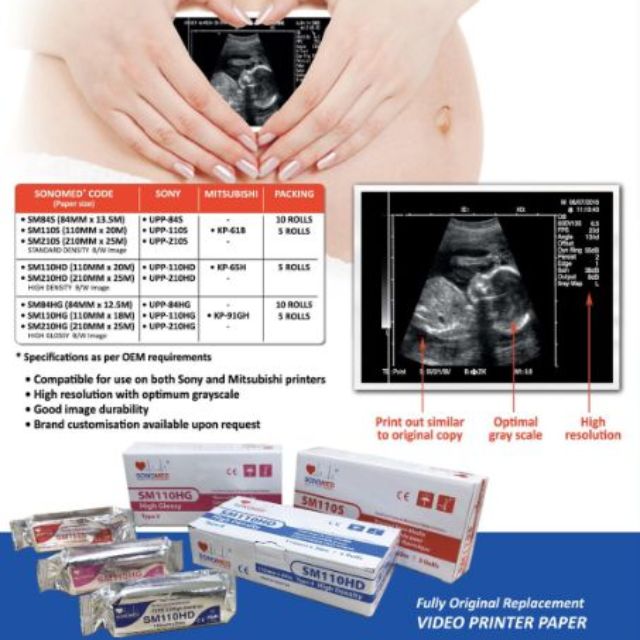 SONOMED Thermal paper for Ultrasound (ultrasound printer paper)