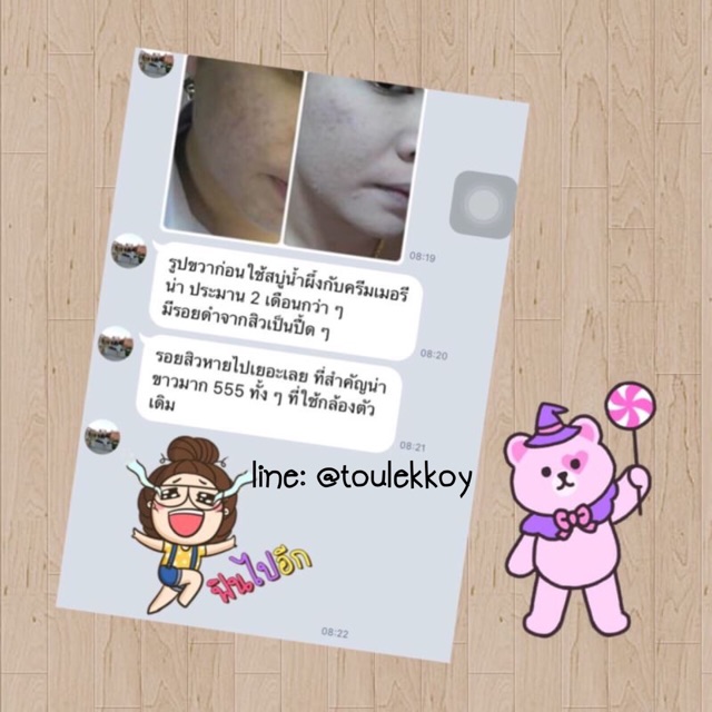 Lot ใหม่!!*พร้อมส่ง^Merina Cream ครีมแก้มบุ๋ม ครีมบำรุงผิวหน้า สูตรอ่อนโยน Merina Cream 4 กรัม