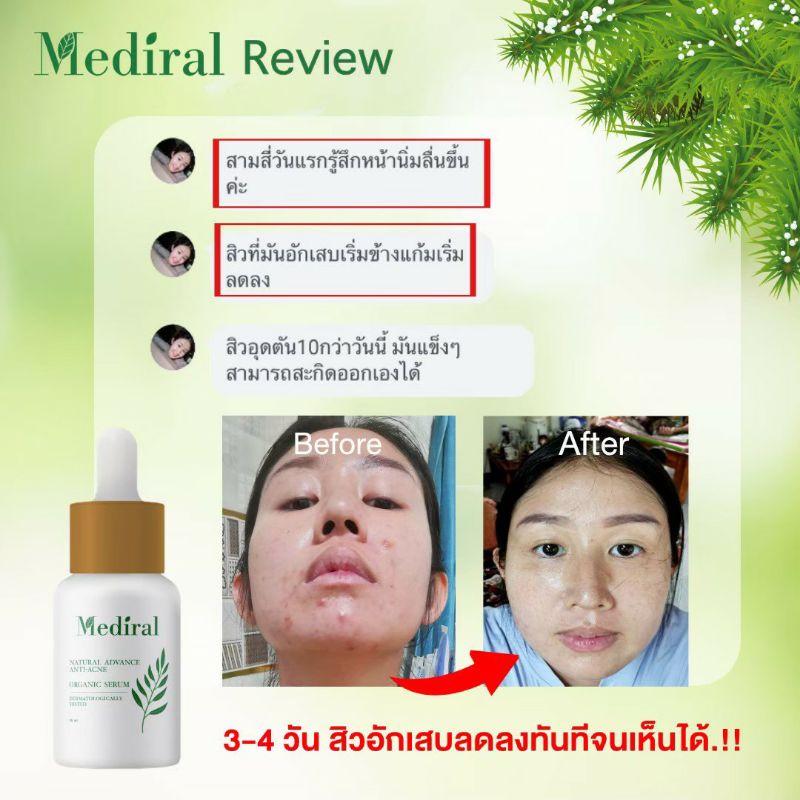 (ราคาส่ง ส่งฟรี) Mediral Organic Serum เวชสำอางค์ออร์แกนิคที่ผู้เชี่ยวชาญแนะนำ สารสกัดธรรมชาติ 24 ชนิดผิวแพ้ง่ายใช้ได้ดี ราคา ถูกที่สุด ดีลบีเคเค แกลเลอรีภาพที่ 7