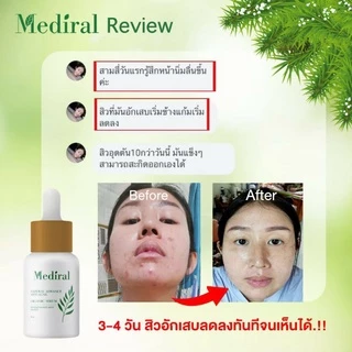 (ราคาส่ง ส่งฟรี) Mediral Organic Serum เวชสำอางค์ออร์แกนิคที่ผู้เชี่ยวชาญแนะนำ สารสกัดธรรมชาติ 24 ชนิดผิวแพ้ง่ายใช้ได้ดี