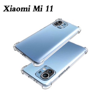 🇹🇭(ส่งจากไทย) เคสใสกันกระแทกคลุมกล้องXiaomi Mi11 5G/Xiaomi Mi 11 /Mi11T/Mi11TPro เคสใสกันกระแทก รุ่นใหม่ล่าสุด