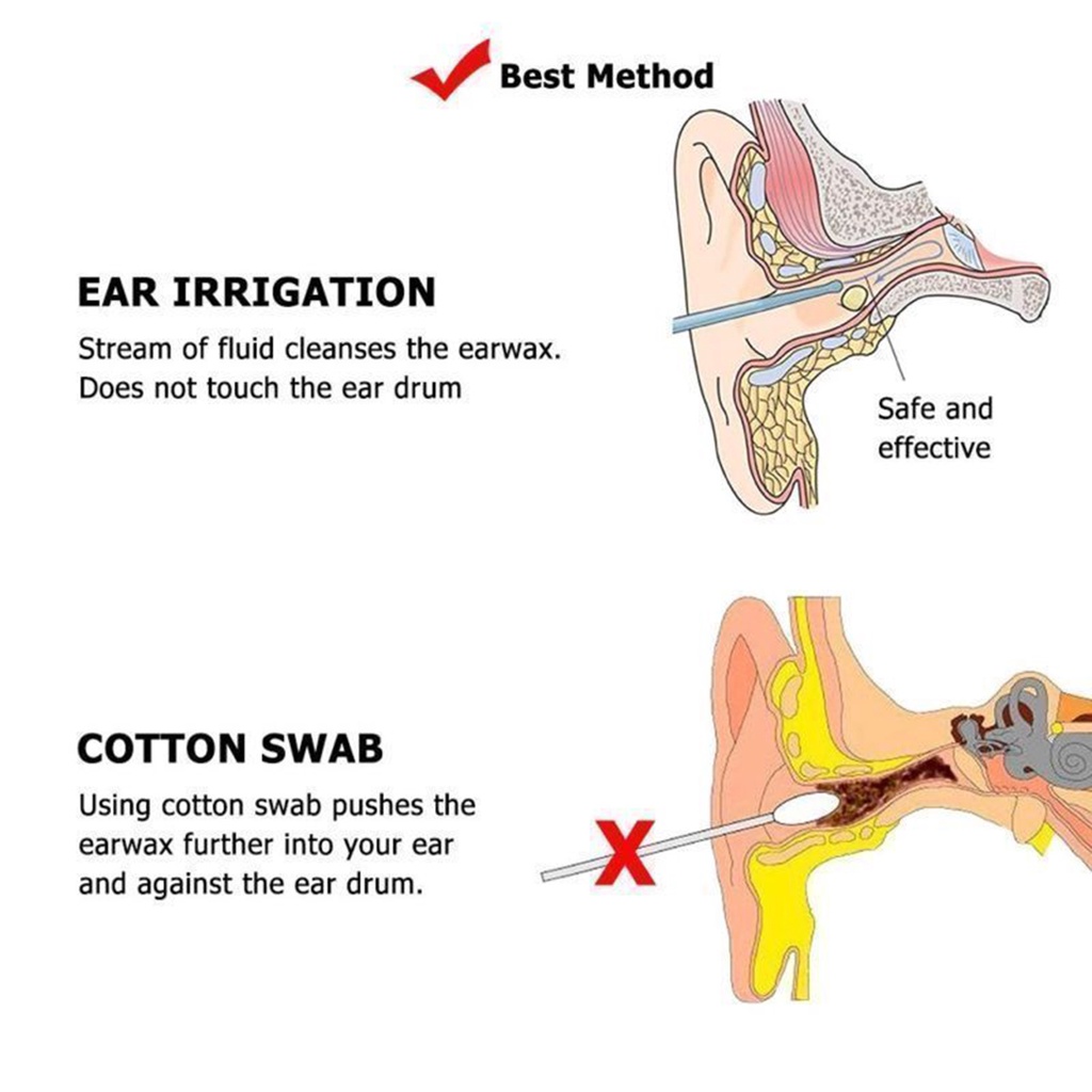 Ear Wax Removal Cleaner เครื่องมือทำความสะอาดไม้แคะขี้หูชลประทาน5อ่าง ...