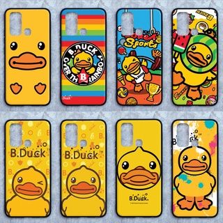 เคส Oppo A15 / A15s ลายเป็ดโง่ ขอบนิ่มหลังแข็ง เคสมือถือเคส Caseเคส TPU ขอบนิ่มหลังแข็ง ไม่ขูดตัวเครื่อง ไม่กัดขอบช่วยปก