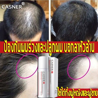 CASNER สเปรย์ปลูกผม 110ml ช่วยปรับปรุงผมร่วง เร่งการเจริญเติบโตของเส้นผม(เซรั่มปลูกไรผม น้ำยาปลูกผม ผมร่วงน้ำยาปลูกผม)