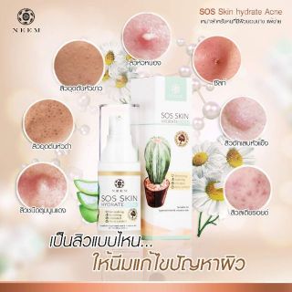 สิว ผิวติดสาร สิวเห่อ แพ้ อักเสบ ‼️ จัดการด้วย NEEM sos skin hydrate acne plus เคลียร์สิวด้วยธรรมชาติล้วนๆ neem natural