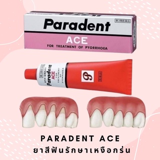 ยาสีฟัน Paradent ACE   ขนาด 40 กรัม รักษาอาการเหงือกร่น