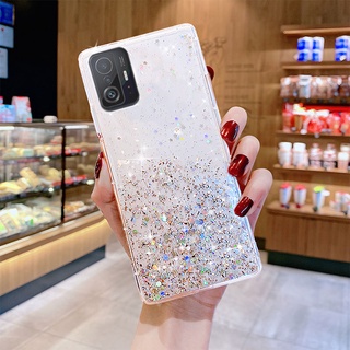 Candy Color Matte Star Glitter เคสโทรศัพท์ เสี่ยวหมี่ สำหรับ Xiaomi mi 11T 11Tpro 11 T pro Ultra Slim ฝาหลังเคสกันกระแทก