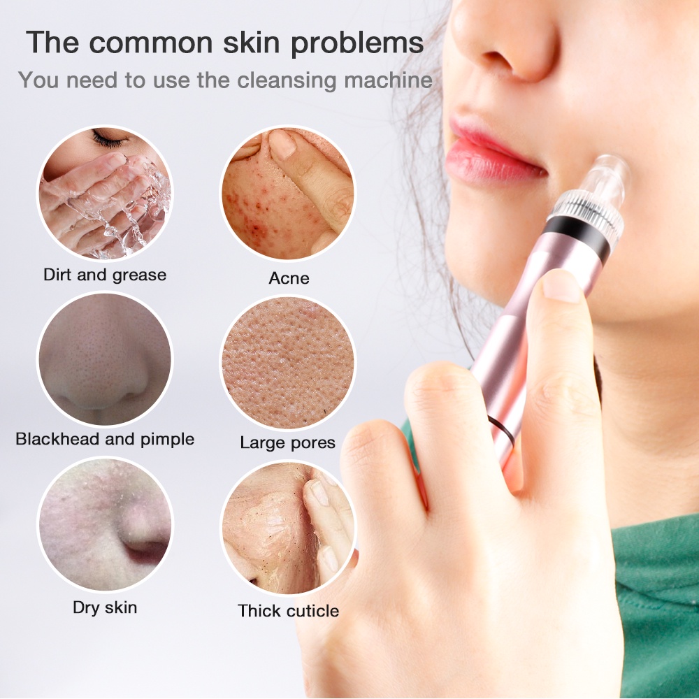 Small Bubbles Beauty Device Suction Blackhead Removal Vacuum ...