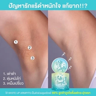 ของแท้💯พร้อมส่ง 💙ครีมรักแร้ขาว ไวท์อัพอาร์มพิท💙 (รับตรงจากบริษัท) โปรดระวังของ**ปลอ-ม**