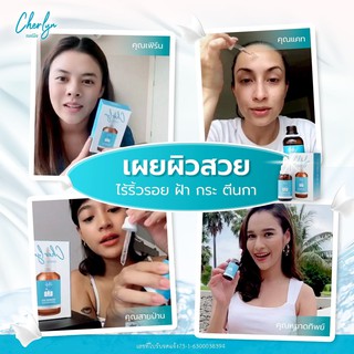 Cherlyn Serum เฌอลีน ล ด ฝ้า ลดรอยคล้ำใต้ตา หน้าใส จบในเซทเดียว