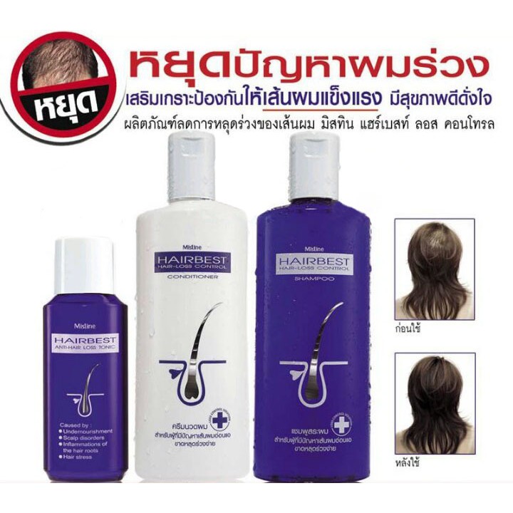 💚ขายถูกที่สุด แท้💯 💦 Mistine Hair Best Hair-Loss Control Series. มี 3 แบบให้เลือก (1 ขวด)