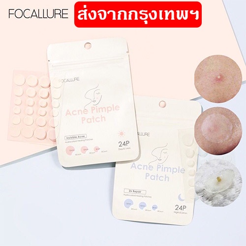 FOCALLURE แผ่นแปะสิว ชนิดมองไม่เห็น ดูแลผิว ซ่อมแซมใบหน้า สูตรกลางวัน กลางคืน 24 ชิ้น ส่งจากกรุงเทพฯ