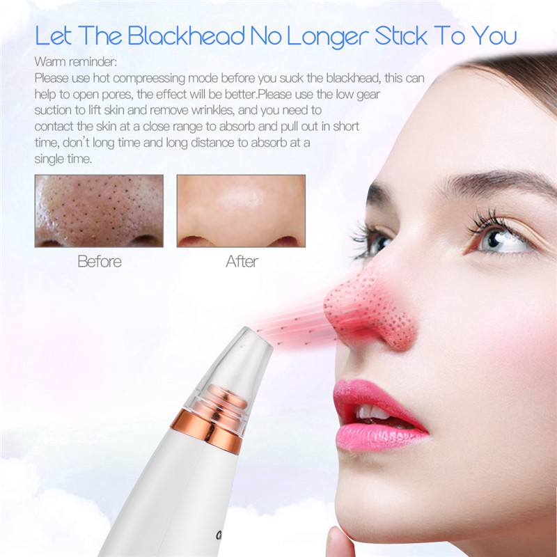 CkeyiN 6 Tips Electric Blackhead Remover Vacuum Suction Acne Comedo