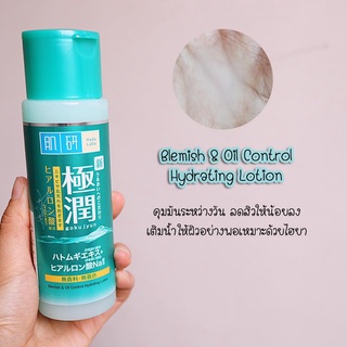 JUL02 ส่งฟรี Hada Labo Blemish Oil Control Hydrating Lotion 170ml  โลชั่นสูตรใหม่ ผิวมีสิวต้องขวดเขียว ช่วยลดรอยบวมแดง