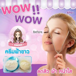 ครีมหน้าใสลดฝ้าฟ้าขาว สูตรดั้งเดิม ของแท้100%