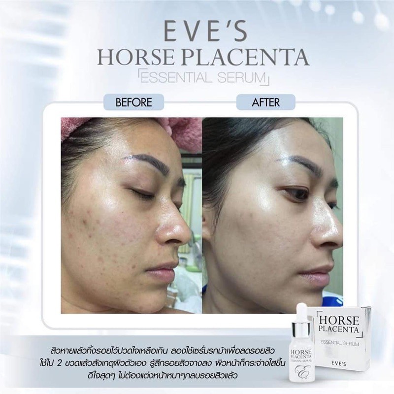 Pack De 6 Sérums KANDA Beauty – Placenta De Cheval – Blanchissant Et Hydratant – Visage – Fabriqué En Thaïlande