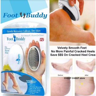 Foot Buddy ที่ขัดส้นเท้า แก้ส้นเท้าแตก เท้าลาย