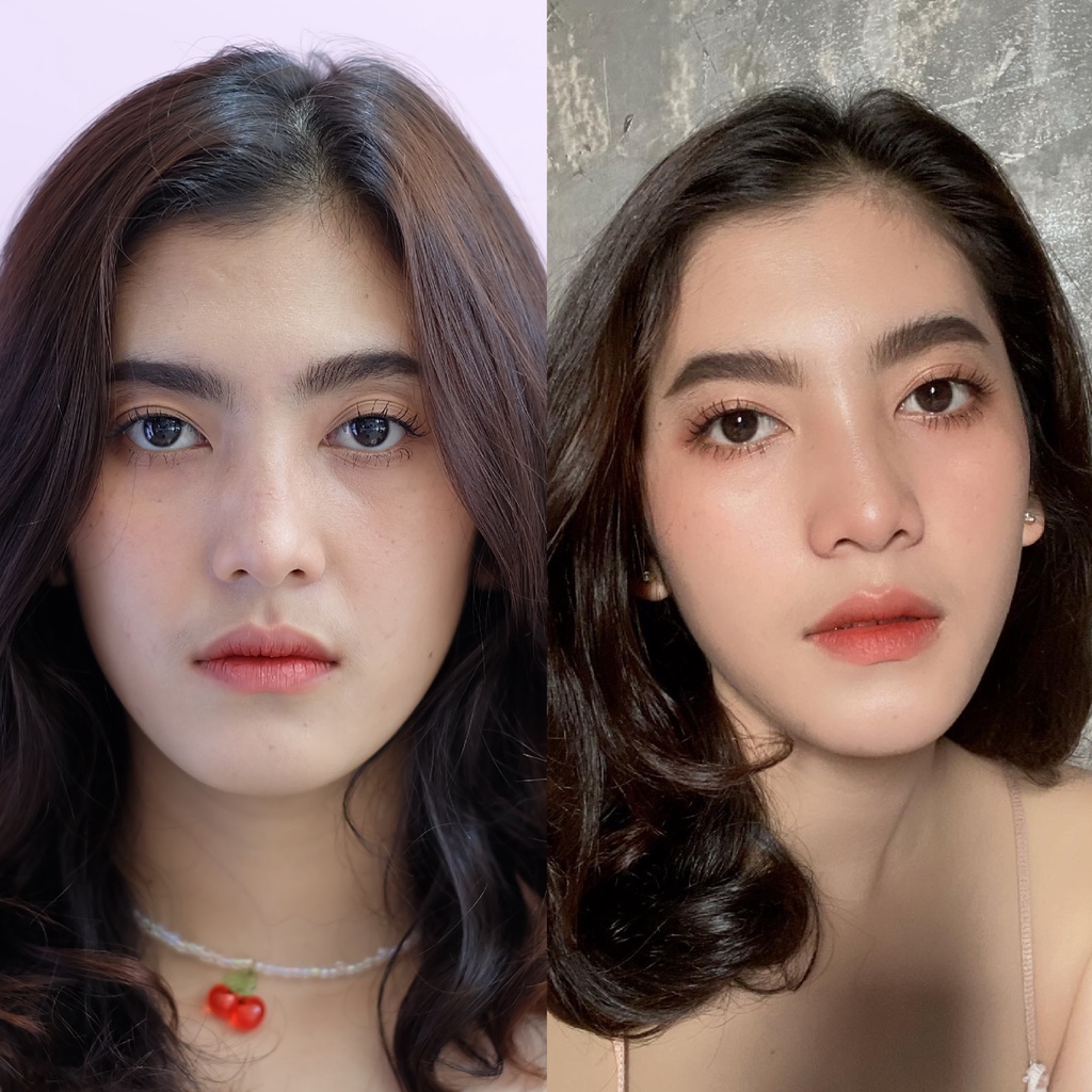 Botox (Nabota) 100 U or Jawline + Face Lift 100 ยู หรือ กราม+ลิฟท์หน้า โบท็อกเกาหลียี้ห้อเดียวที่ได้ US FDA