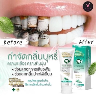 ยาสีฟันคุณตั้ม (Khuntum)