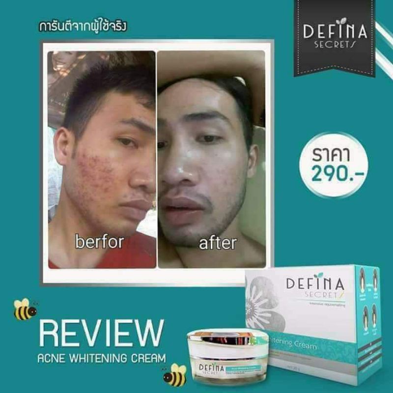 Define (ครีมดีฟีน่า)