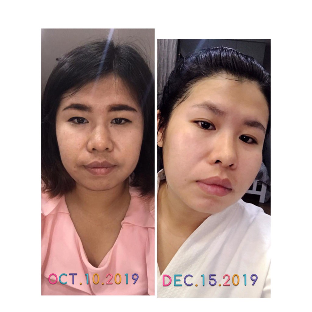 Bonita Facial Massage Gel Gold